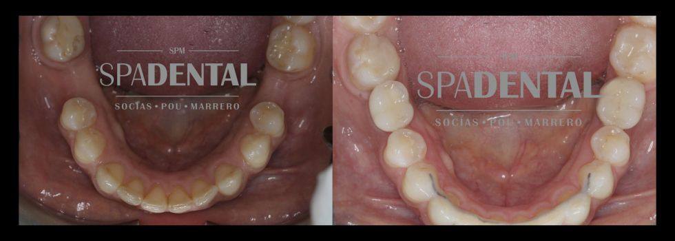  Indisciplinaria 5