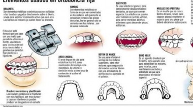 Adultos con Brackets