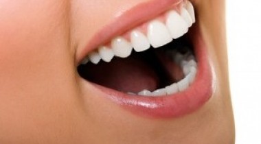 Ortodoncia invisible para mejorar la sonrisa